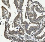 ANAPC2 Antibody in Immunohistochemistry (Paraffin) (IHC (P))