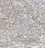 SEMA6A Antibody in Immunohistochemistry (Paraffin) (IHC (P))