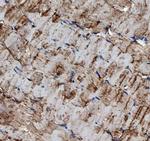 TRIM72 Antibody in Immunohistochemistry (Paraffin) (IHC (P))