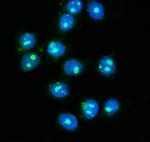 NOLA1 Antibody in Immunocytochemistry (ICC/IF)