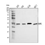 NOLA1 Antibody in Western Blot (WB)