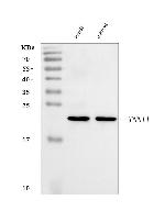 TNNI1 Antibody in Western Blot (WB)