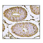 Nectin 2 Antibody in Immunohistochemistry (Paraffin) (IHC (P))