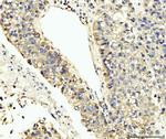 LAR4B Antibody in Immunohistochemistry (Paraffin) (IHC (P))