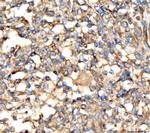 AP2A2 Antibody in Immunohistochemistry (Paraffin) (IHC (P))