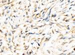 AP2A2 Antibody in Immunohistochemistry (Paraffin) (IHC (P))