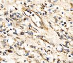 AP2A2 Antibody in Immunohistochemistry (Paraffin) (IHC (P))