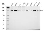 AP2A2 Antibody in Western Blot (WB)