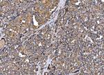 MLXIP Antibody in Immunohistochemistry (Paraffin) (IHC (P))