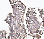 MLXIP Antibody in Immunohistochemistry (Paraffin) (IHC (P))