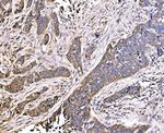 MLXIP Antibody in Immunohistochemistry (Paraffin) (IHC (P))