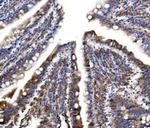 MLXIP Antibody in Immunohistochemistry (Paraffin) (IHC (P))