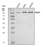 MLXIP Antibody in Western Blot (WB)