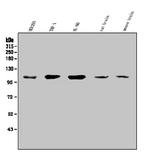 SEZ6L Antibody in Western Blot (WB)