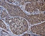 RG9MTD1 Antibody in Immunohistochemistry (Paraffin) (IHC (P))