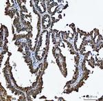 RG9MTD1 Antibody in Immunohistochemistry (Paraffin) (IHC (P))