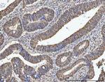 RG9MTD1 Antibody in Immunohistochemistry (Paraffin) (IHC (P))