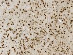 Nova-2 Antibody in Immunohistochemistry (Paraffin) (IHC (P))