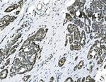 HOXD11 Antibody in Immunohistochemistry (Paraffin) (IHC (P))