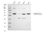 TMPRSS13 Antibody in Western Blot (WB)