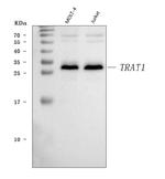 TRIM Antibody in Western Blot (WB)