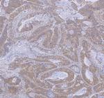 WDR44 Antibody in Immunohistochemistry (Paraffin) (IHC (P))