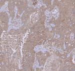 WDR44 Antibody in Immunohistochemistry (Paraffin) (IHC (P))