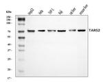 TARS2 Antibody in Western Blot (WB)