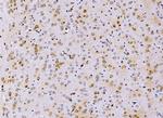 PSMD8 Antibody in Immunohistochemistry (Paraffin) (IHC (P))