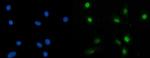 SBNO1 Antibody in Immunocytochemistry (ICC/IF)