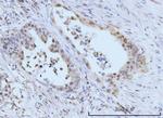 SBNO1 Antibody in Immunohistochemistry (Paraffin) (IHC (P))