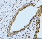 SBNO1 Antibody in Immunohistochemistry (Paraffin) (IHC (P))