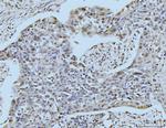 SBNO1 Antibody in Immunohistochemistry (Paraffin) (IHC (P))