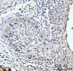 SBNO1 Antibody in Immunohistochemistry (Paraffin) (IHC (P))