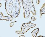 SBNO1 Antibody in Immunohistochemistry (Paraffin) (IHC (P))