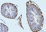 SBNO1 Antibody in Immunohistochemistry (Paraffin) (IHC (P))