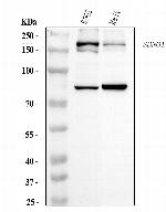 SBNO1 Antibody in Western Blot (WB)