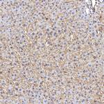 TIMD2 Antibody in Immunohistochemistry (Paraffin) (IHC (P))