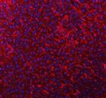 TIMD2 Antibody in Immunohistochemistry (Paraffin) (IHC (P))