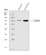 TIMD2 Antibody in Western Blot (WB)