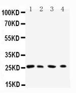 RAB3C Antibody in Western Blot (WB)