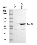 GATA5 Antibody in Western Blot (WB)