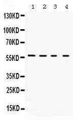 KV1.2 (KCNA2) Antibody in Western Blot (WB)