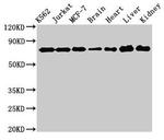 DDX3 Antibody in Western Blot (WB)