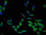 LCK Antibody in Immunocytochemistry (ICC/IF)