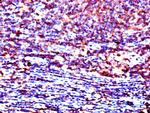 LCK Antibody in Immunohistochemistry (Paraffin) (IHC (P))