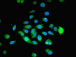 MYADM Antibody in Immunocytochemistry (ICC/IF)