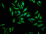 Mesothelin Antibody in Immunocytochemistry (ICC/IF)