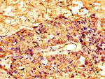 Mesothelin Antibody in Immunohistochemistry (Paraffin) (IHC (P))