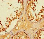 LYPD2 Antibody in Immunohistochemistry (Paraffin) (IHC (P))